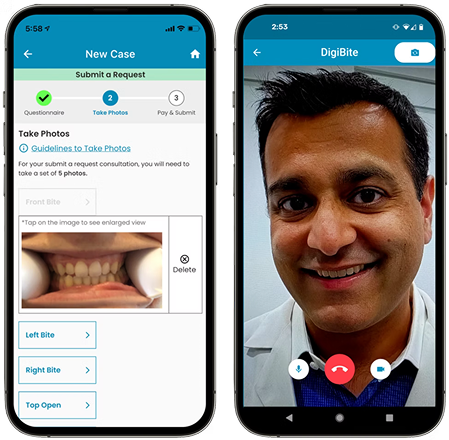 DigiBite dental app screenshots